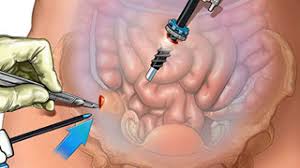 Oligospermia Treatment in Sonipat: Low Sperm Count Symptoms, Causes & Best Treatment Options