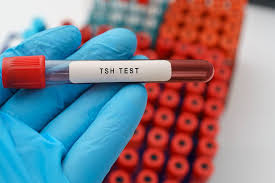 TSH Levels in Pregnancy Chart: Normal, High & Dangerous Ranges Explained