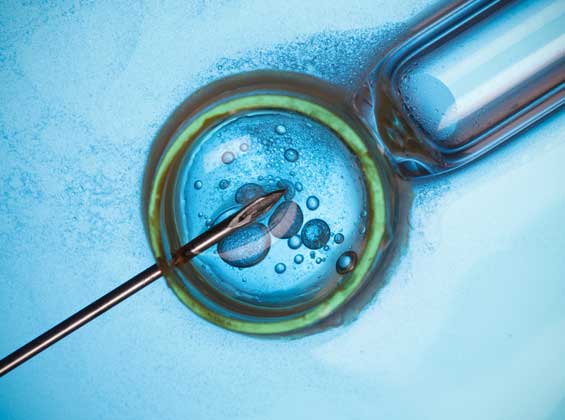 ICSI Treatment